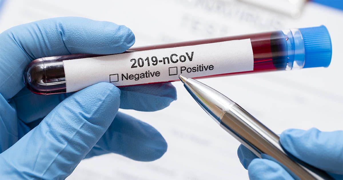 Coronavirus-análisis-2