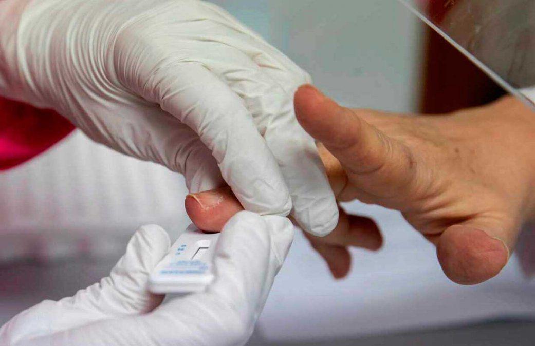 crearon-un-test-rapido-anticuerpos-coronavirus